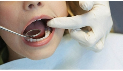 Diş Sorunlarına ve Nedenleri