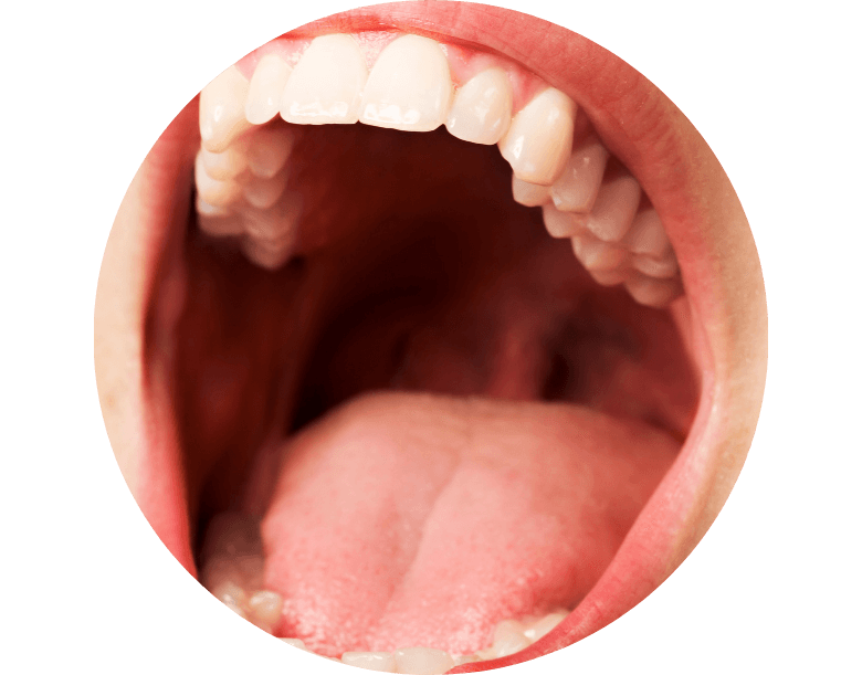 Ağız Kanseri Nedir?