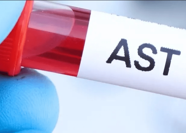 AST (Aspartat Aminotransferaz) Nedir? AST Yüksekliği ve Düşüklüğü